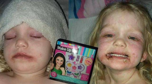 3-letnie dziecko w poważnym stanie po zabawie zestawem do makijażu!