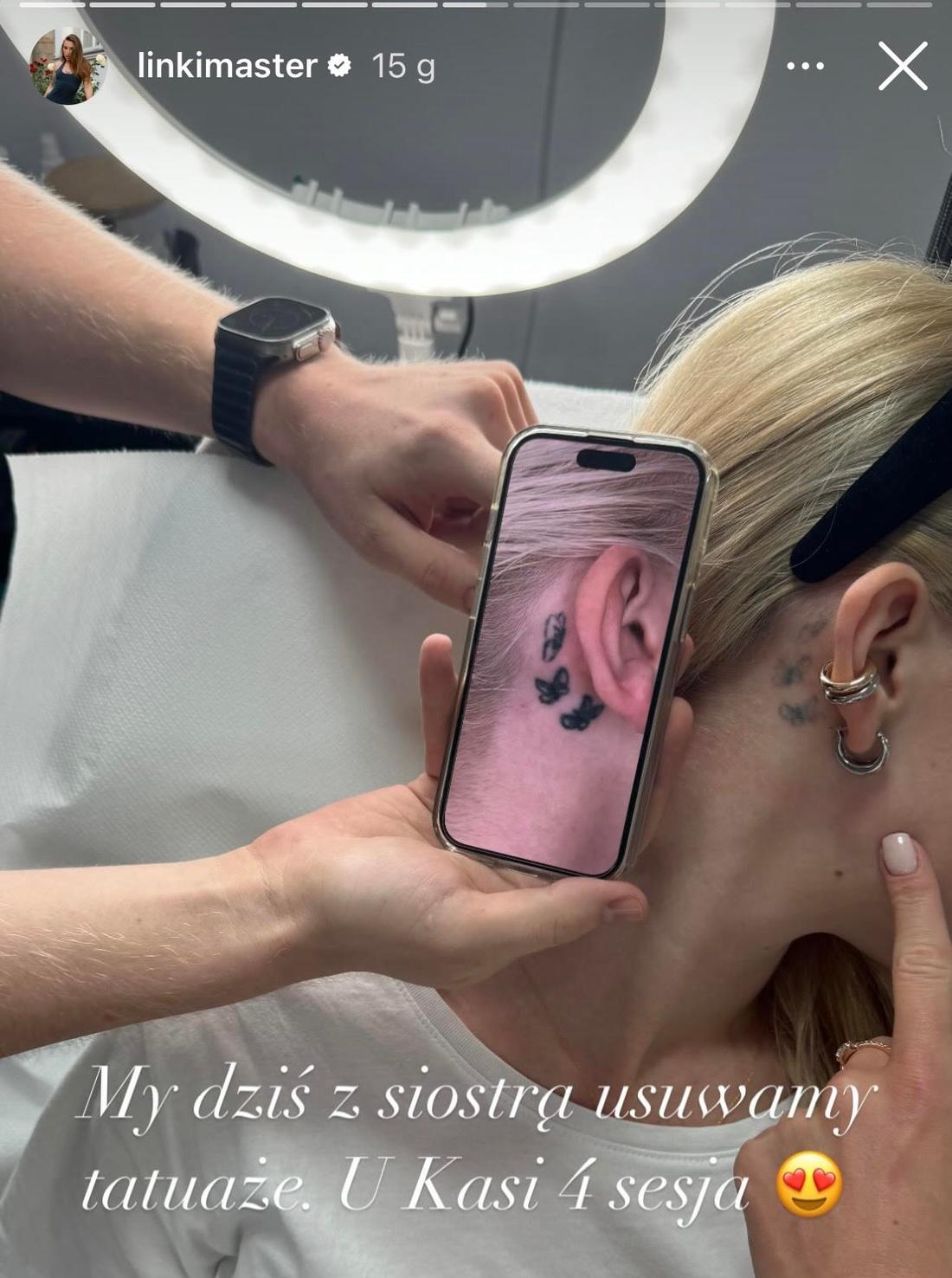 Młodsza siostra Marty Linkiewicz na usuwaniu tatuażu