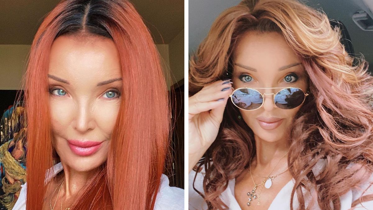 Ewa Minge zmaga się z silną reakcją alergiczną, IG: eva_minge