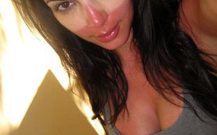 Poparzona Kim Kardashian (FOTO)