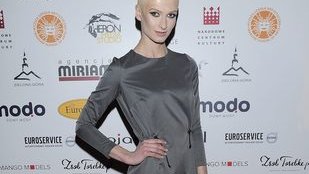 Anna Piszczałka bez włosów (FOTO)