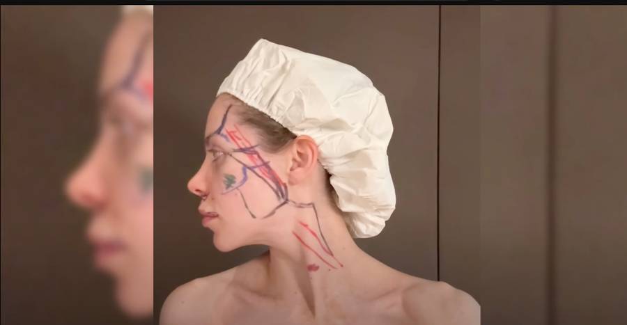 Julia Von Stein odsłoniła kulisy liftingu twarzy. Zabrała kamery nawet na salę operacyjną!