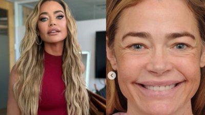 55-letnia Denise Richards przeszła lifting twarzy. Fani nie poznają jej po zabiegu