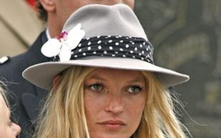 Na ręce Kate Moss wyrosło coś obrzydliwego