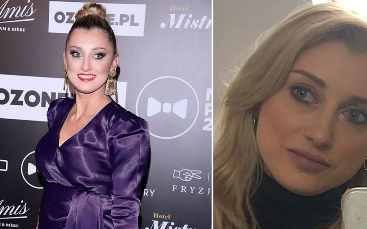 Justyna Żyła powiększyła usta! Dobrze wygląda?