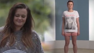 Ten problem sprawia, że wiele kobiet wstydzi się pokazać swoje ciało (VIDEO)