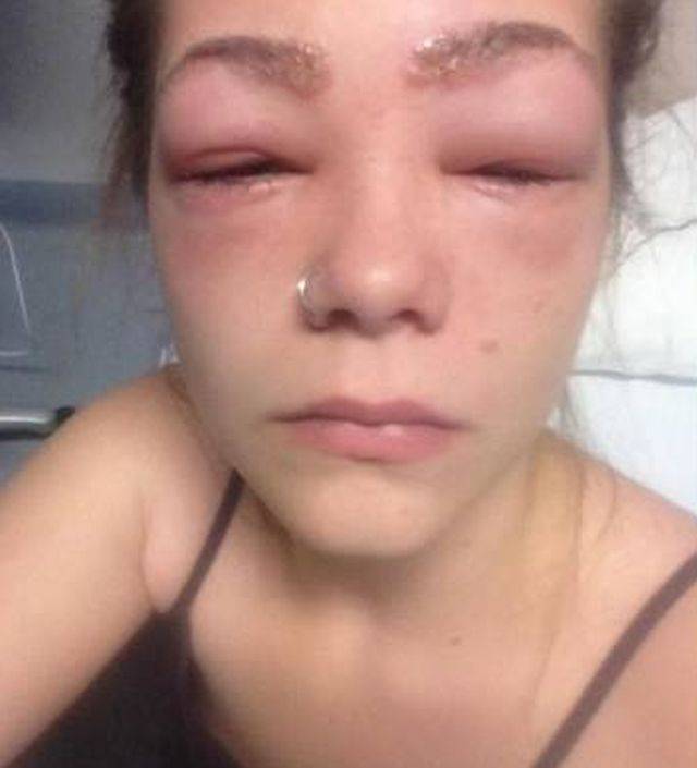 Po użyciu bardzo popularnego kosmetyku stało jej się TO