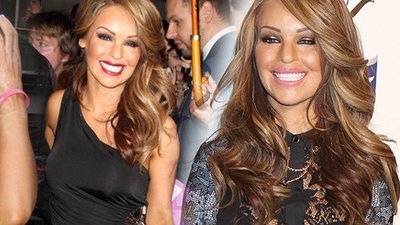 Oblana kwasem Katie Piper wraca na salony (FOTO)