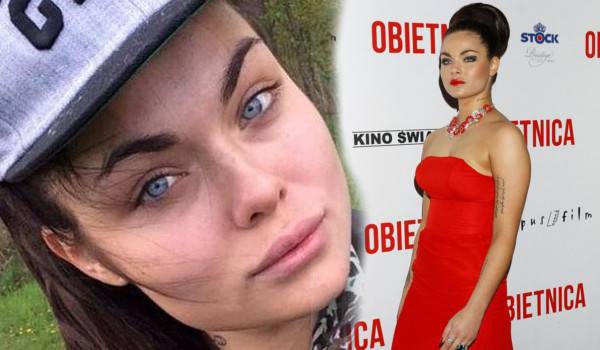 Te gwiazdy borykają się z trądzikiem