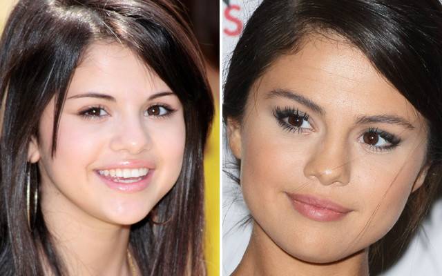 Jak pieniądze zmieniły twarze gwiazd?