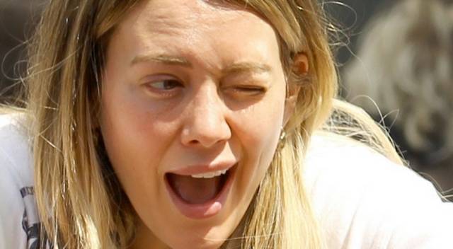 Co się stało z twarzą Hilary Duff?!