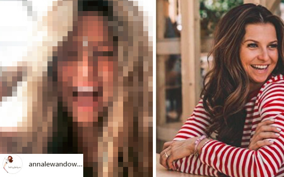 Lewandowska DRASTYCZNIE zmieniła fryzurę! To będzie HIT tego lata!