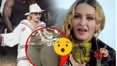 Co się stało z PUPĄ Madonny? Fani są zszokowani jej wyglądem