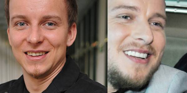 Jak zęby zmieniły twarze gwiazd