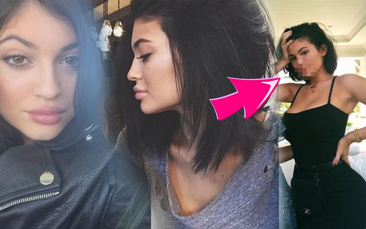 NEWS DNIA! Kylie Jenner USUNĘŁA wypełniacze z UST