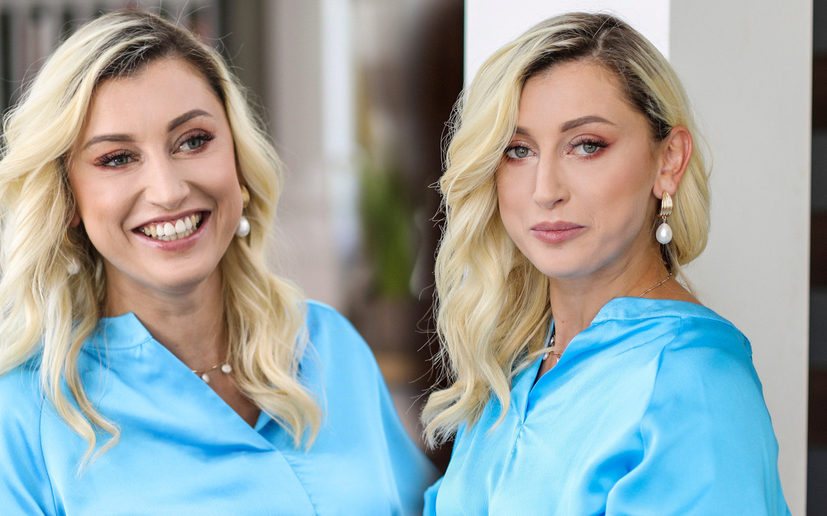 Justyna Żyła przeszła OGROMNĄ metamorfozę wizerunkową. Klinika udostępniła zdjęcia gwiazdy PRZED i PO