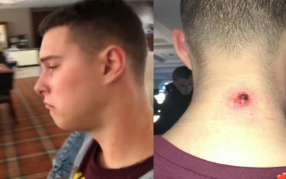 TYM musi zająć się chirurg! Wiemy czym jest wielka KROSTA Adama Zdrójkowskiego!