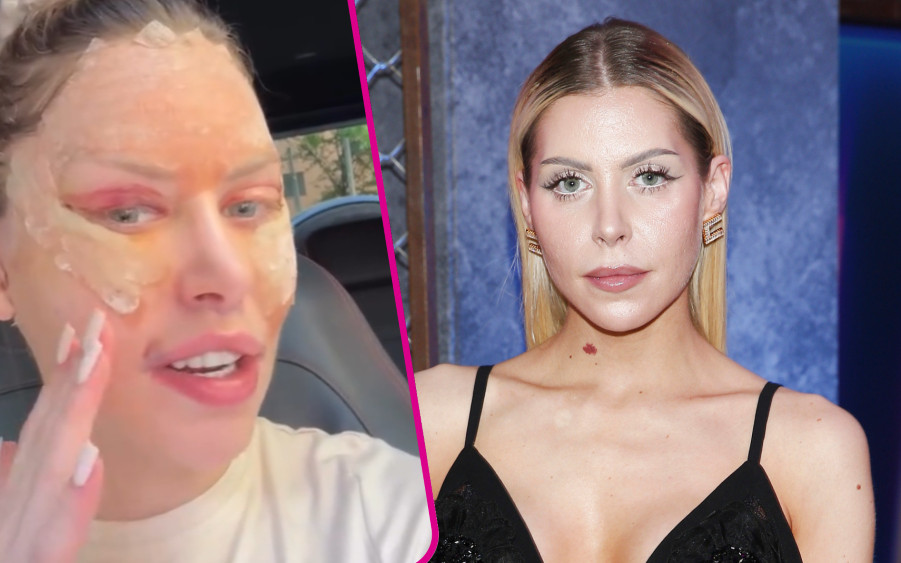 29-letnia Julia Von Stein ujawnia, jakim zabiegom poddała się przy okazji liftingu: “Więcej chyba się już nie dało” (WIDEO)