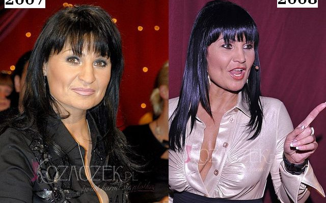Iwona Pavlović ma nowy nos