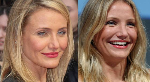 Jakich zabiegów urodowych żałują gwiazdy?