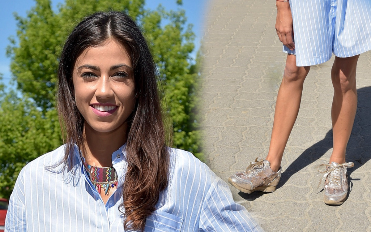 Maja Hyży pokazała ogromną bliznę na nodze (ZDJĘCIE)