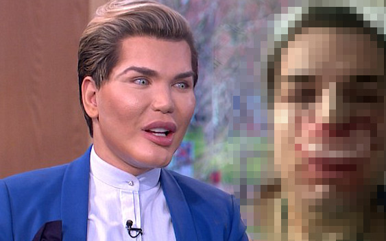 Żywemu Kenowi ODPADA NOS! Rodrigo Alves przesadził z operacjami