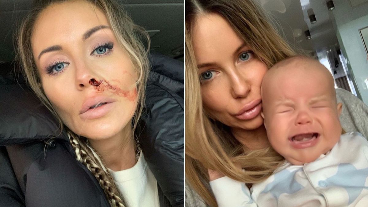 Zakrwawiona Małgorzata Rozenek, for. Instagram