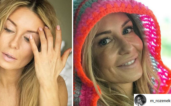 Co się stało z ustami Małgorzaty Rozenek? Internautki zauważyły coś niepokojącego