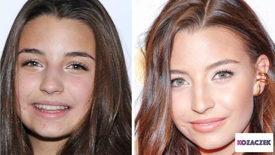 Które polskie gwiazdy powiększały usta? Porównujemy zdjęcia – STARE i NOWE