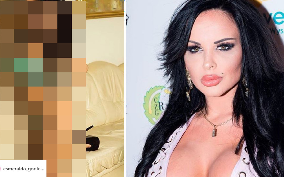 Godlewska na pierwszym zdjęciu po wypadku. Internauci: Powinnaś się WSTYDZIĆ!