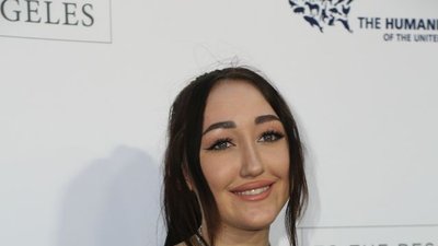 OMG! Co się dzieje z twarzą Noah Cyrus?!