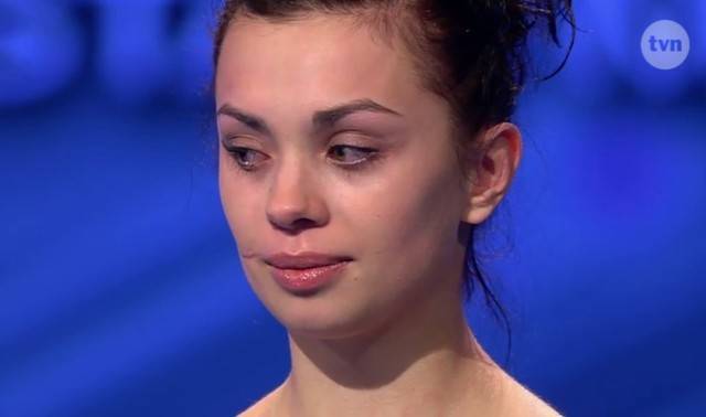 Uczestniczka “Top Model” z blizną. Anna Koryto przeszła gigantyczną metamorfozę