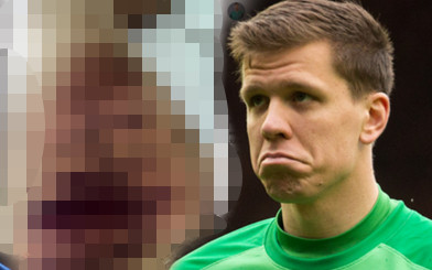 Wojciech Szczęsny pokazał nogę po kontuzji! Straszne! (FOTO)