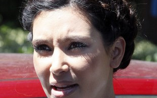 Kim Kardashian przestała stosować botoks