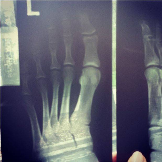 Szpitalne (i powypadkowe) sweet focie gwiazd