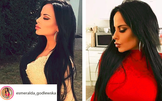 Drastycznie przerobiona Godlewska kasuje komentarze. Fani: Aż się trawa wygięła!