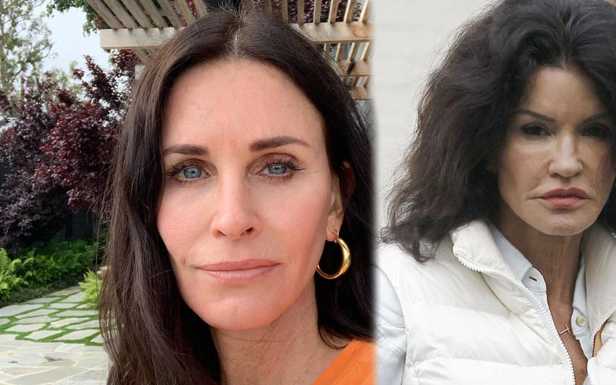 OMG jak ONI wyglądają?! Nieudane operacje plastyczne Gwiazd