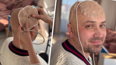 Tak Adrian Szymaniak walczy z rakiem. Sprzęt za ogromne pięniądze