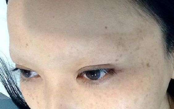 Uważaj na ten NIEBEZPIECZNY trend. Ta kobieta straciła przez niego brwi!