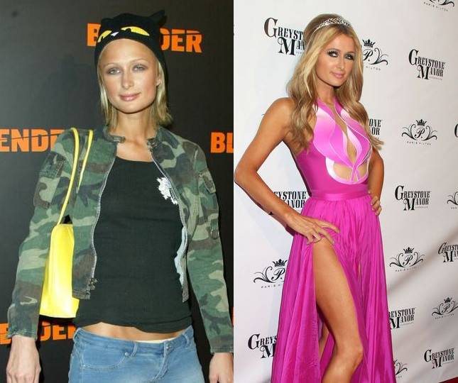 Nie ma ludzi brzydkich, są tylko biedni – także w Hollywood