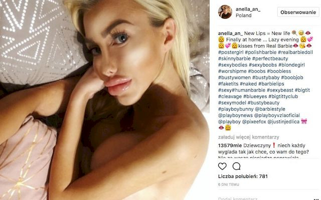 Oto Anella, polska Barbie, której usta są wielkości PONTONÓW