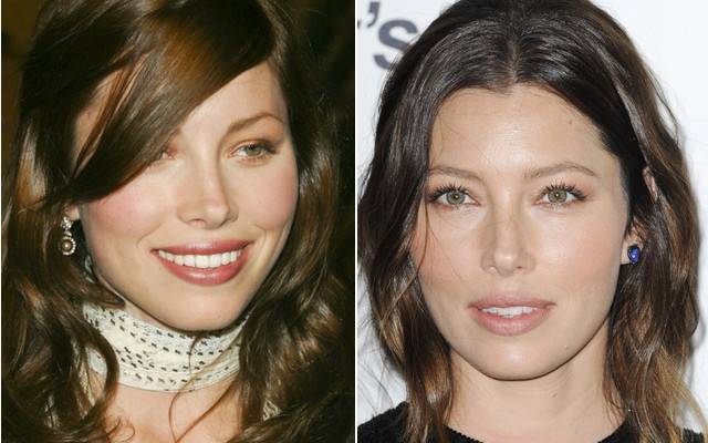 Jak pieniądze zmieniły twarze gwiazd?