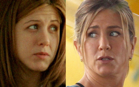 Jak operacja nosa zmieniała twarze gwiazd