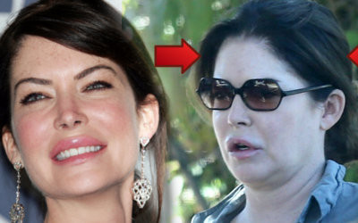 Lara Flynn Bloyle powinna być przestrogą dla Kylie Jenner