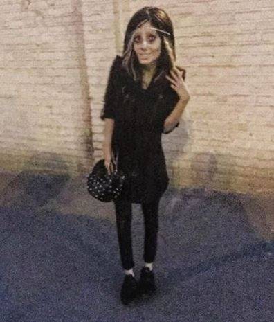 Jej marzeniem było być jak Angelina Jolie, a teraz STRASZY swoim wyglądem