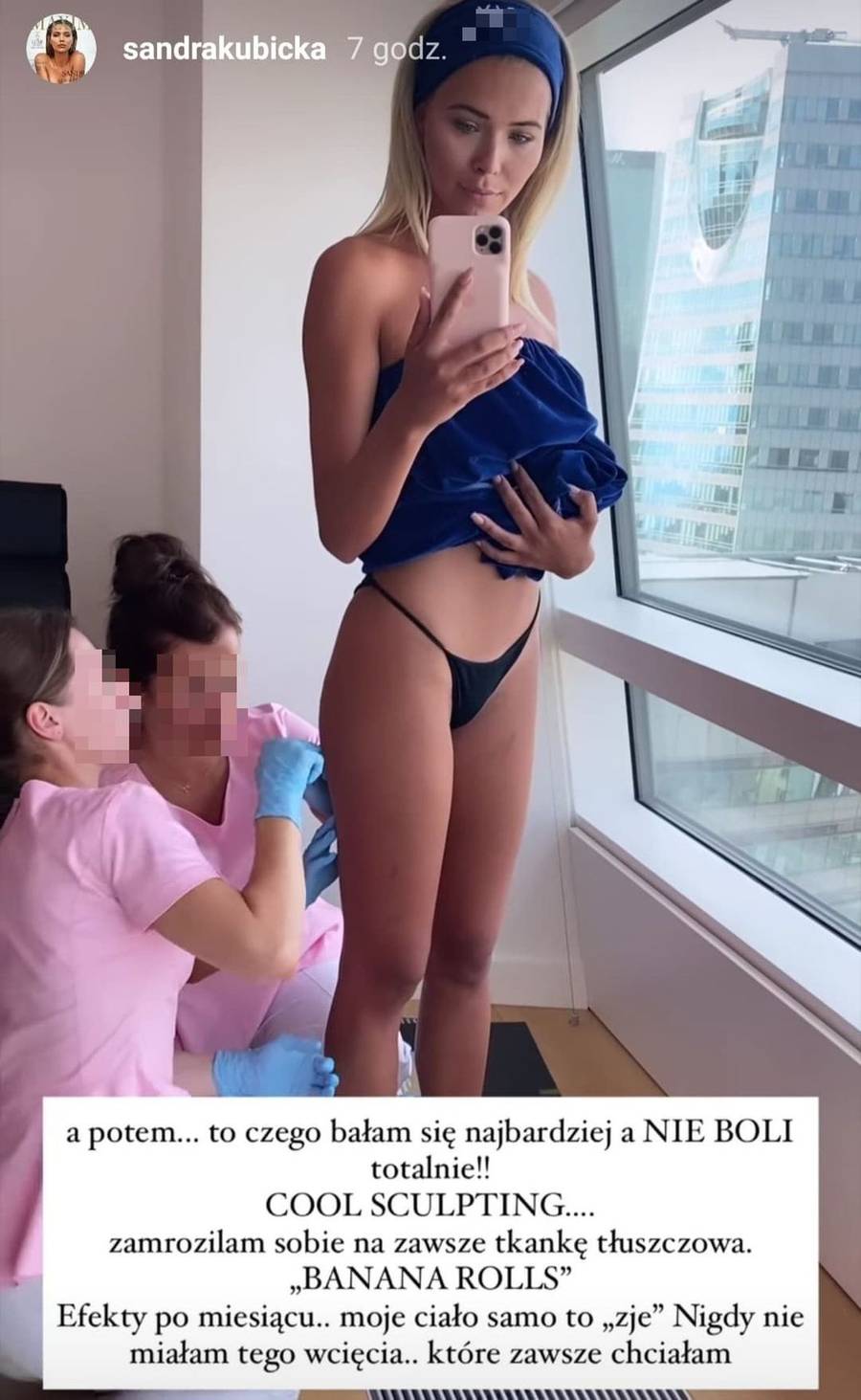 Sandra Kubicka zrobiła zabieg na pośladki