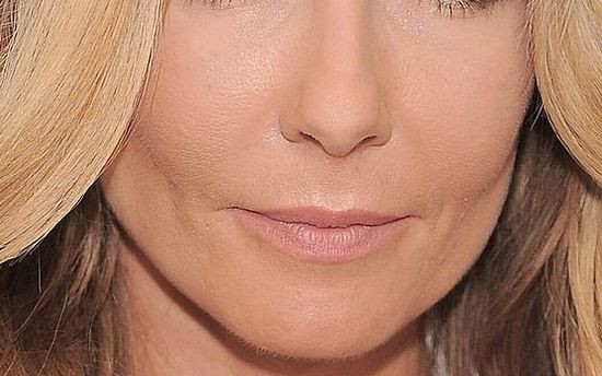 10 zaskakujących zbliżeń na twarz Małgorzaty Rozenek
