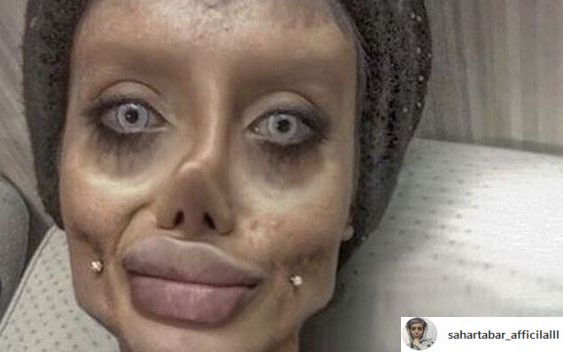 Sahar Tabar zabrała głos w sprawie swoich operacji plastycznych!