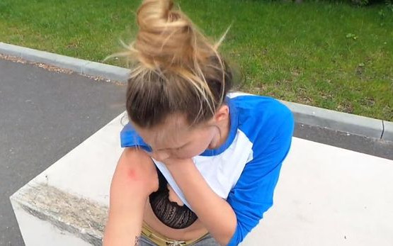 Marta Wierzbicka poobijała się jeżdżąc na deskorolce [VIDEO]