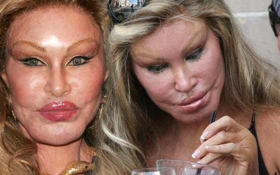 Jak wyglądała kobieta – kot przed operacjami? Dlaczego chciała zostać kotem?